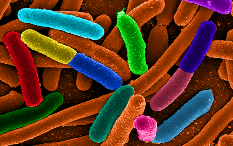 e_coli