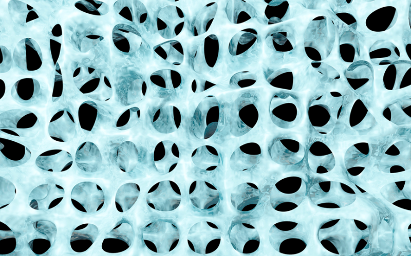 osteoporosis